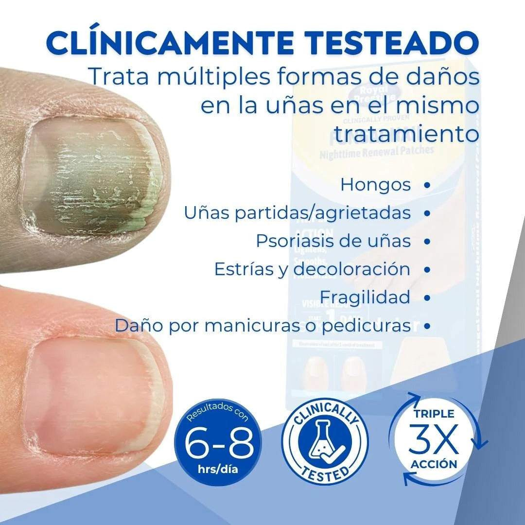 Parches Anti Hongos Para Uñas ¡SUPER OFERTA 2x1! 36 parches
